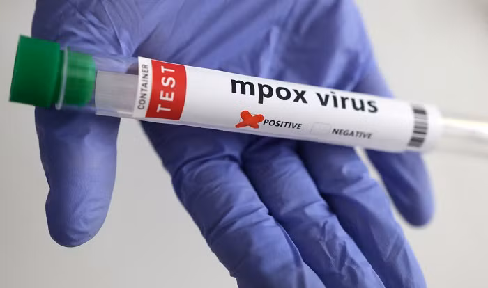 The Africa Centers for Disease Control and Prevention (Africa CDC) said mpox vaccination could start "in the coming days" as the number of cases surges across Africa.