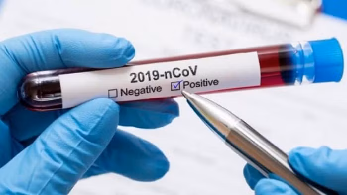 Myanmar has decided to extend COVID-19 preventive measures until June 30, according to the Central Committee on Prevention, Control and Treatment of COVID-19.