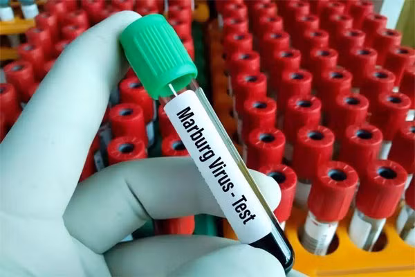 Illustrative image (Photo: Internet)