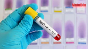 Ministry of Health urges proactive measures to prevent Nipah virus at hospitals