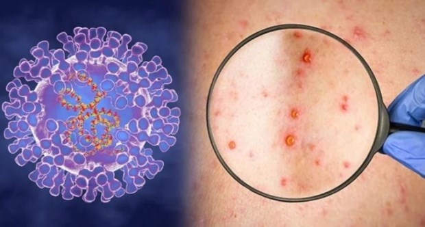 Illustrative image (Photo: The Ministry of Health)