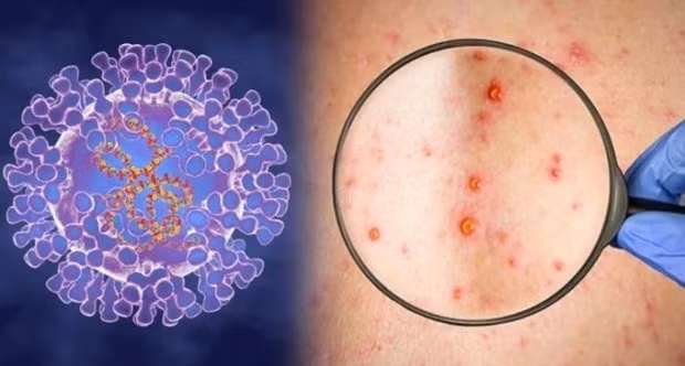 Illustrative image (Photo: The Ministry of Health)