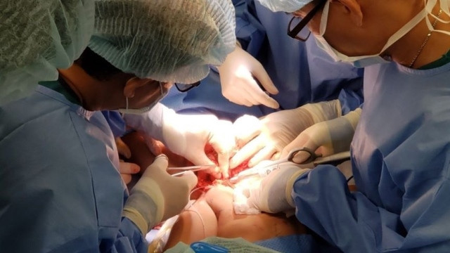 Doctors successfully separate the conjoined twins.