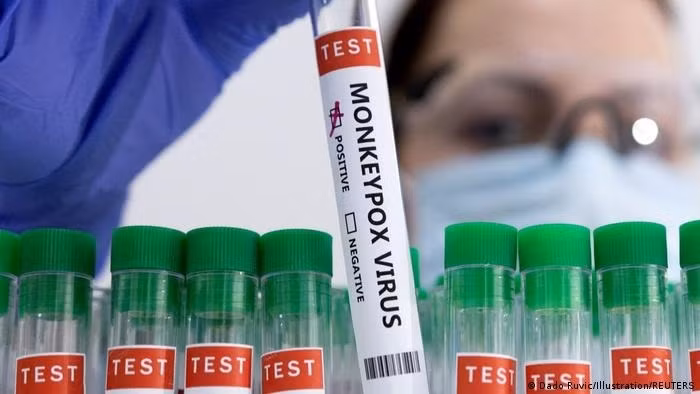  Australia said on Thursday the spread of monkeypox was now a "communicable disease incident of national significance" to allow for a more coordinated response, following the World Health Organization's declaration of a global health emergency.