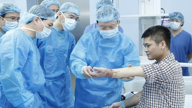 Vietnamese doctors have successfully performed the world’s first hand transplant with the donor hand comes from a living donor. (Photo courtesy of the 108 Military Hospital)
