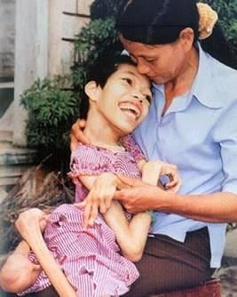 Photos on Agent Orange victims on display in Can Tho