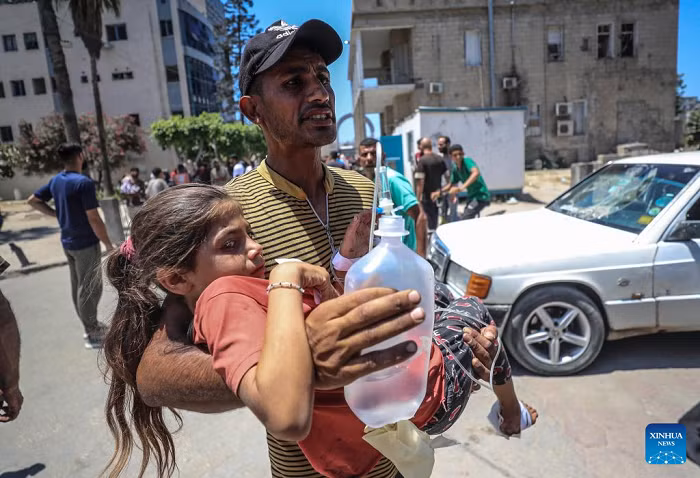 A wounded Palestinian girl is carried by a man at a hospital following an Israeli airstrike in Gaza City, on July 13, 2025. At least 58 Palestinians were killed by Israeli airstrikes and gunfire across the Gaza Strip on Sunday, Palestinian sources said. (Photo: Xinhua)