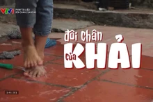 The documentary Khal’s Walk (Doi chan cua Khai), produced and directed by Hong Hanh, won first prize in the Professional Non-Fiction category.