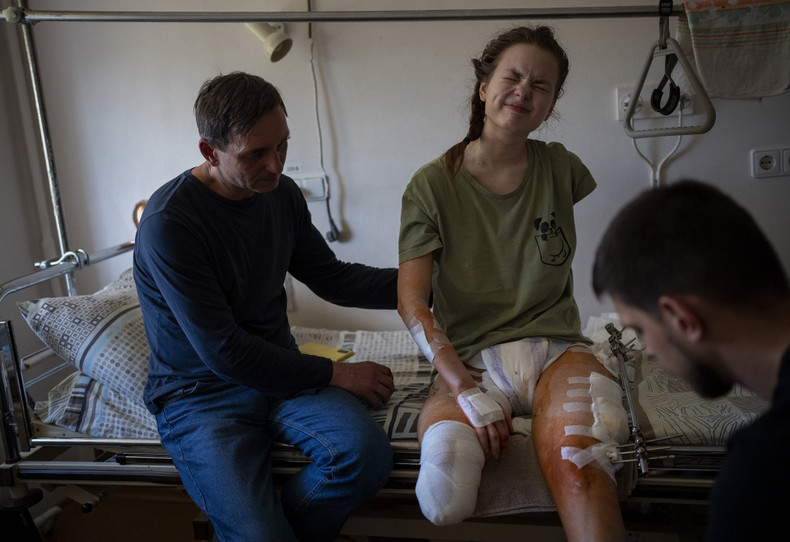 Emilio Morenatti's photo is about a young girl who was injured and had her right leg amputated during the conflict in Ukraine. (Source: World Press Photo)
