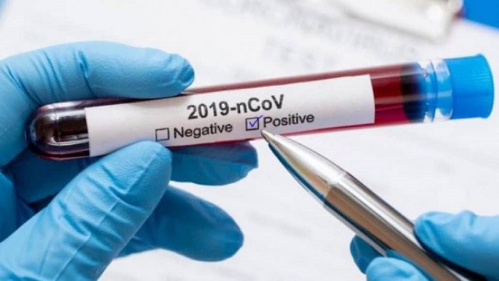 Myanmar has decided to extend COVID-19 preventive measures until June 30, according to the Central Committee on Prevention, Control and Treatment of COVID-19.