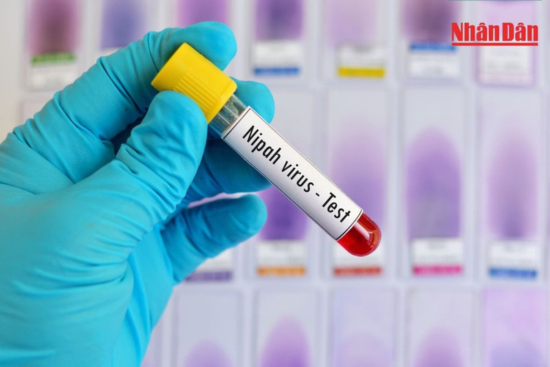 Ministry of Health urges proactive measures to prevent Nipah virus at hospitals