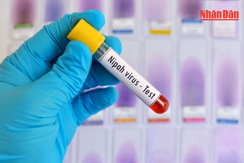 Ministry of Health urges proactive measures to prevent Nipah virus at hospitals