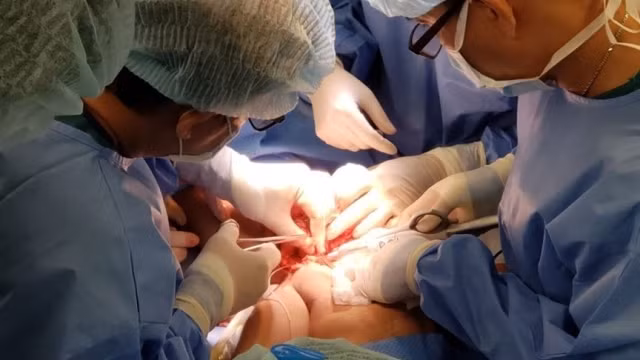 Doctors successfully separate the conjoined twins.