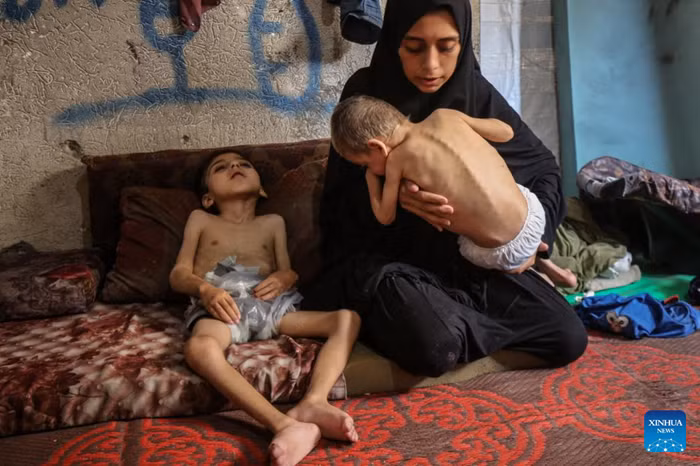 Two displaced Palestinian children suffering from malnutrition and cerebral palsy are seen inside a school-turned shelter in the northwest of Gaza City, July 25, 2025. (Photo: Xinhua)